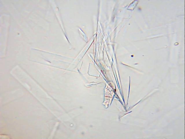 Zuckerkristalle Honig.JPG